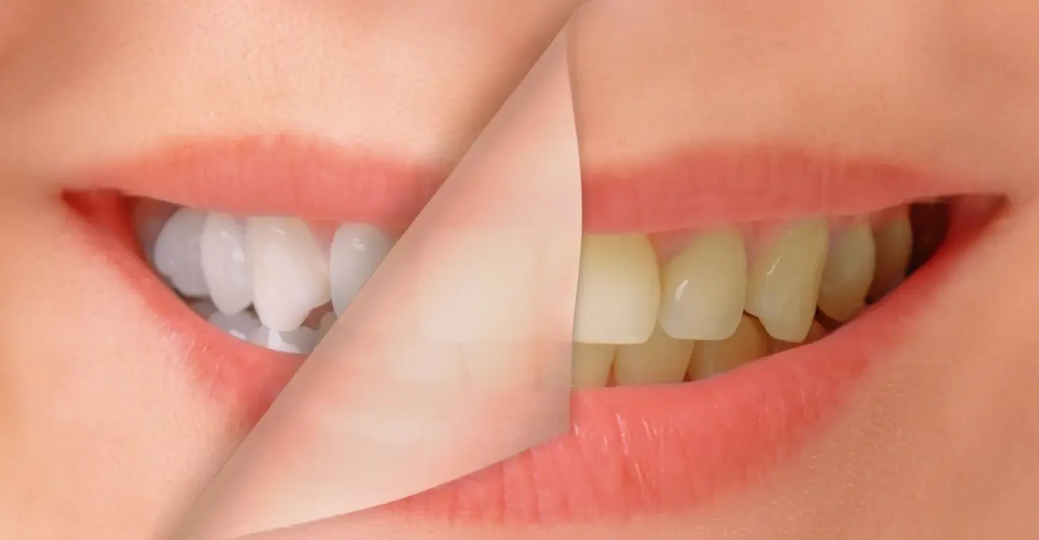 TikTok Dental Hacks 2